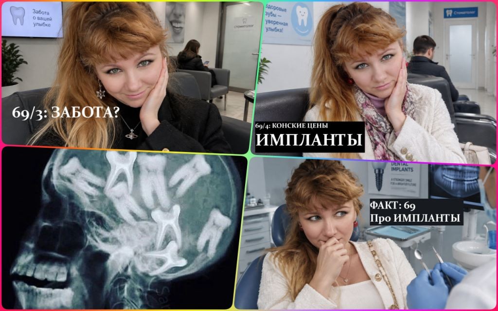 Хомяк с надутой щекой: Как мне ставили импланты, факты обо мне 69/5 Хомяк с надутой щекой: Как мне ставили импланты, факты обо мне 69/5